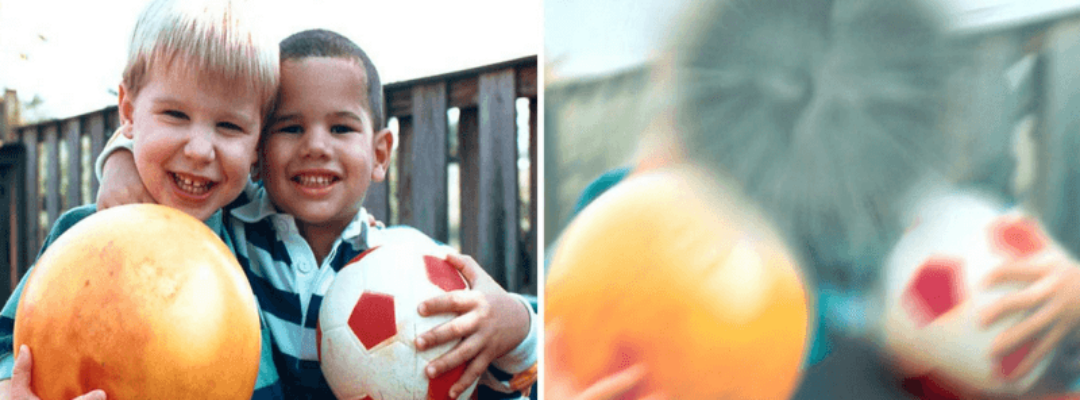 The difference in vision of a healthy eye and one suffering from AMD. The latter has a dark spot that obscures vision in the center of the picture